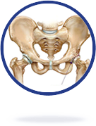 Anterior Total Hip Arthroplasty