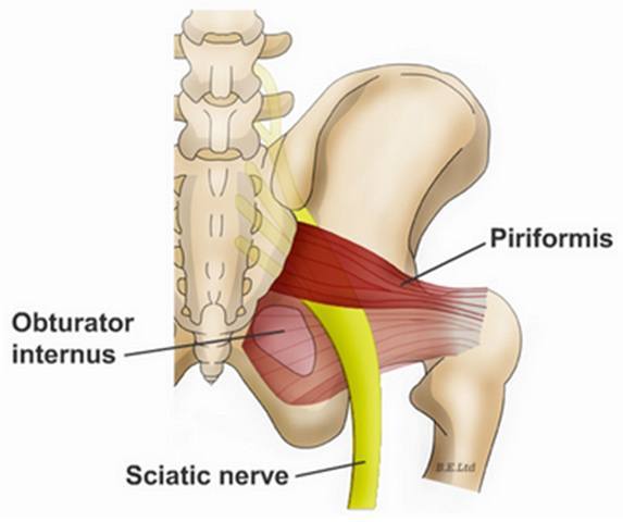 Piriformis Syndrome Washington DC